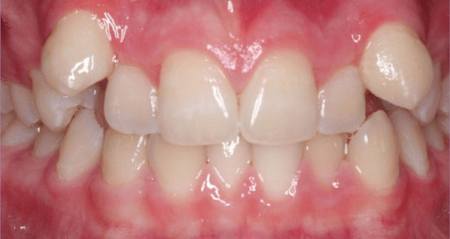 Before treatment 1
