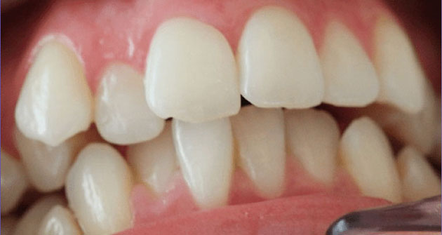 Before treatment 3